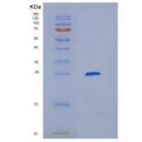 小鼠甲型肝炎病毒细胞受体1(HAVCR1)重组蛋白
