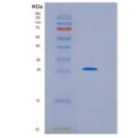 人次黄嘌呤磷酸核糖基转移酶1(HPRT1)重组蛋白