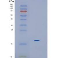 人组氨酸三聚体核苷结合蛋白2(HINT2)重组蛋白