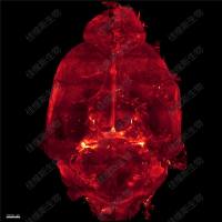 全脑c-Fos免疫荧光染色 小鼠全脑组织透明化三维成像