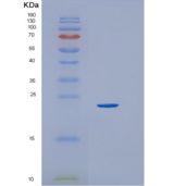 人HEBP1重组蛋白