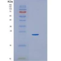 人HEBP1重组蛋白