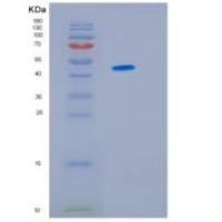 人热休克蛋白47(Colligin)重组蛋白