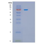 人70kDa热休克蛋白5(HSPA5)重组蛋白