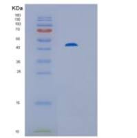 人组氨酸标签蛋白磷酸酶2C（His-PP2Cα）重组蛋白