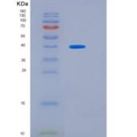 人热休克因子2-结合(HSF2BP)重组蛋白