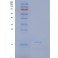 人干扰素γ(IFNg)重组蛋白