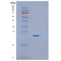 人V-Ha-Ras肉瘤病毒癌基因同源物(HRAS)重组蛋白