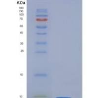 人触珠蛋白相关蛋白(HPR)重组蛋白