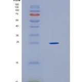 人Ⅱ类主要组织相容性复合体DRβ1(HLA-DRB1)重组蛋白