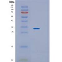 人HPGD重组蛋白
