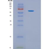 人肝素酶(HPSE)重组蛋白