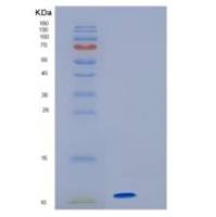 人高迁移率族AT Hook蛋白2(HMGA2)重组蛋白