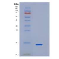 人白介素33(IL33)重组蛋白