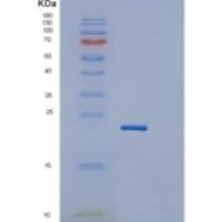 小鼠胰岛素样生长因子结合蛋白6(IGFBP6)重组蛋白