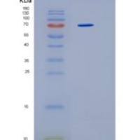 人热休克蛋白70(氨基酸1-641)重组蛋白