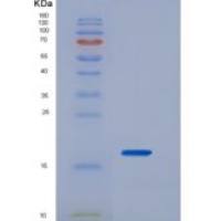 人白介素2(IL2)重组蛋白
