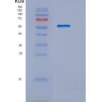 人氨基己糖苷酶Aα(HEXa)重组蛋白