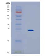 人HLA-DOA重组蛋白