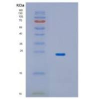 人HPCAL1重组蛋白