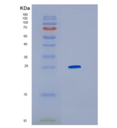 人高迁移率族蛋白1(HMGB1)重组蛋白