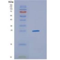 人HDGFRP3重组蛋白