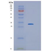 人HDHD3重组蛋白