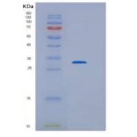 人HDHD3重组蛋白