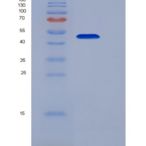人白介素32(IL32)重组蛋白