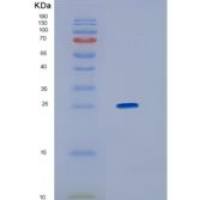 人高迁移率族蛋白1(HMGB1)重组蛋白