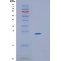 人Ⅱ类主要组织相容性复合体DRα(HLA-DRA)重组蛋白