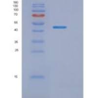 小鼠白介素1β(IL1b)重组蛋白