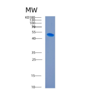 人细胞间粘附分子1(ICAM1)重组蛋白