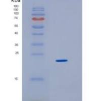 人高迁移率族框蛋白3(HMGB3)重组蛋白