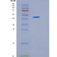 人HSFY1重组蛋白