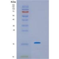 人HRSP12重组蛋白