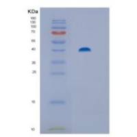 人Hip/ST13重组蛋白
