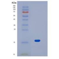 人嵌合蛋白1(CHN1)重组蛋白
