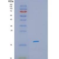 人HSPB11重组蛋白