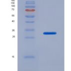 人干扰素γ诱导蛋白30(IFI30)重组蛋白产品图