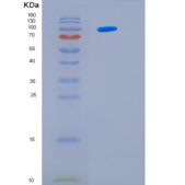 大肠杆菌Hsp104（氨基酸1-908）酿酒酵母重组蛋白