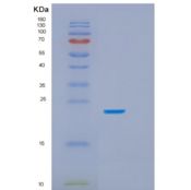 人HSPB8/HSP22重组蛋白