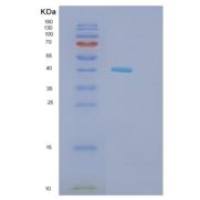 小鼠组蛋白脱乙酰基酶8(HDAC8)重组蛋白