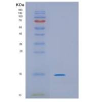 人类HRAS抑制因子3重组蛋白