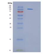 人己糖激酶3(HK3)重组蛋白