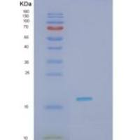 人HDDC3重组蛋白