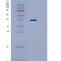 大肠杆菌IdhA重组蛋白
