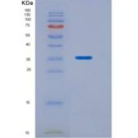 人同源盒蛋白Hox-C11重组蛋白