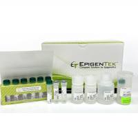 EpiQuik CUT＆RUN m6A RNA富集（MeRIP）试剂盒 现货|EpiQuik CUT&RUN m6A RNA Enrichment (MeRIP) Kit