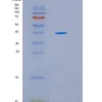 人热休克蛋白40(DNAJ) 重组蛋白